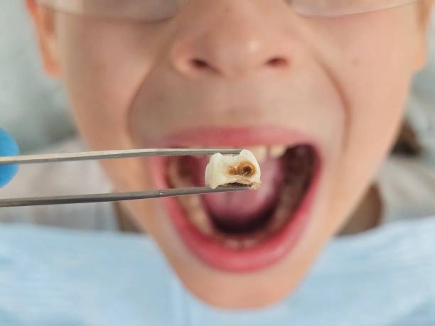 Best Pediatric Emergency Dentist in Whitehouse, TX